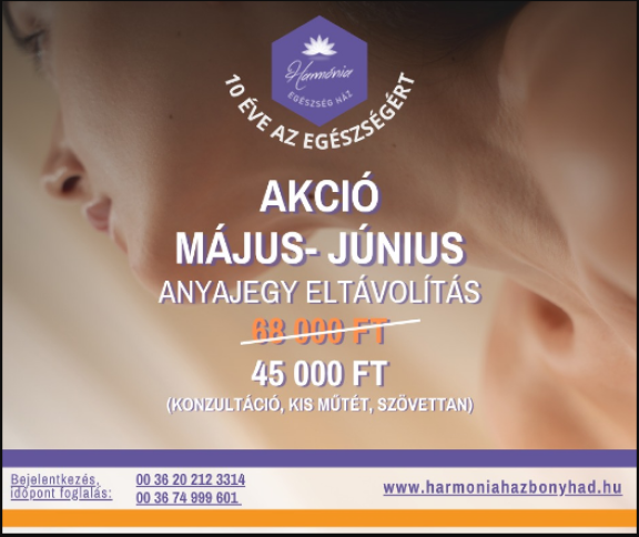 AKCIÓ Május–Júniusi Anyajegy eltávolítás